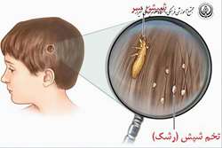 معاینه مو پدیکلوزیس و آموزش اصول بهداشتی مراقبت از مو